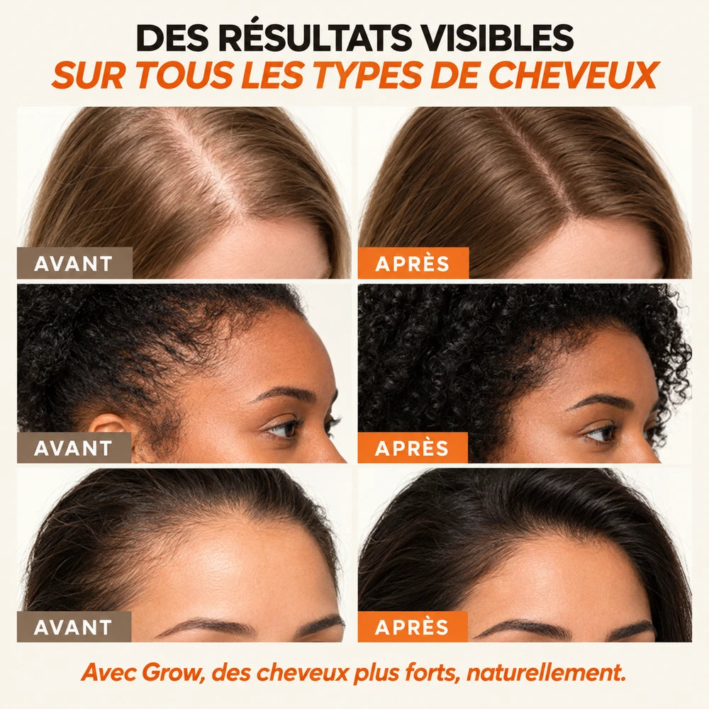 Grow Sérum